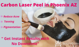 Read more about the article How Do Carbon Laser Facial Works?