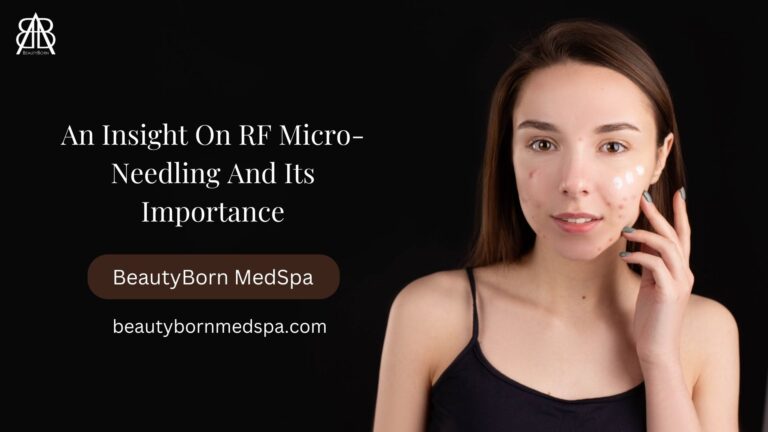 An Insight On RF Micro-Needling And Its Importance