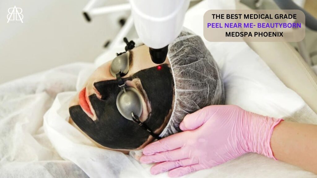 Laser Carbon Peel in phoenix, AZ - Best Medical-Grade Peel Near Me