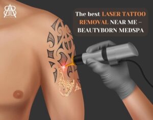 Read more about the article THE BEST LASER TATTOO REMOVAL NEAR ME – BEAUTYBORN MEDSPA, PHOENIX, ARIZONA, WHERE TIMELESS BEAUTY IS BORN!