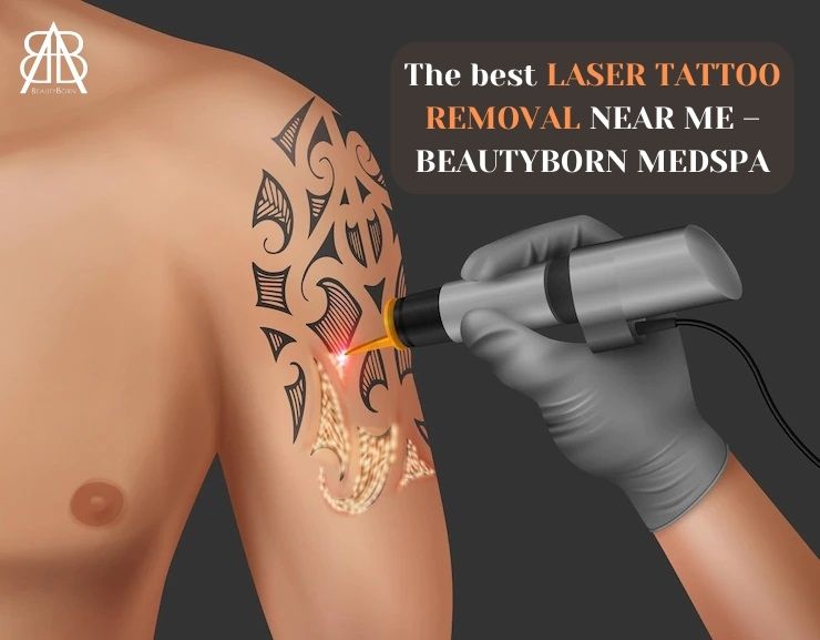You are currently viewing THE BEST LASER TATTOO REMOVAL NEAR ME – BEAUTYBORN MEDSPA, PHOENIX, ARIZONA, WHERE TIMELESS BEAUTY IS BORN!