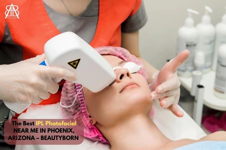 You are currently viewing THE BEST IPL PHOTOFACIAL NEAR ME IN PHOENIX, ARIZONA – BEAUTYBORN MEDSPA, WHERE TIMELESS BEAUTY IS BORN!