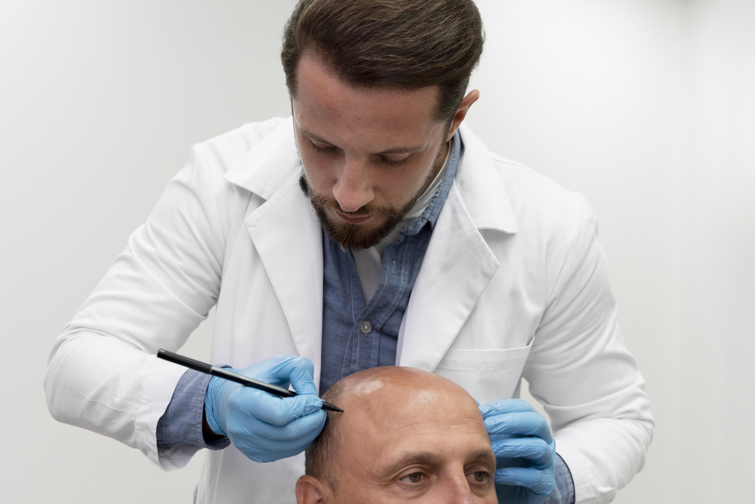 Read more about the article Should I Get a Hair Transplant?